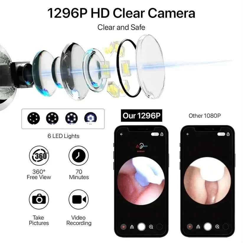 Smart WiFi Ear Cleaner with 1296P HD Camera