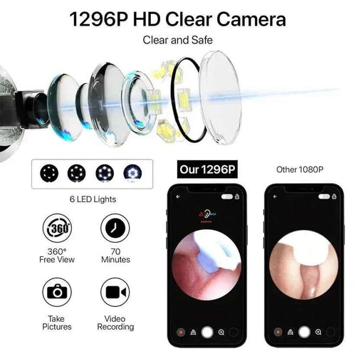 Smart WiFi Ear Cleaner with 1296P HD Camera