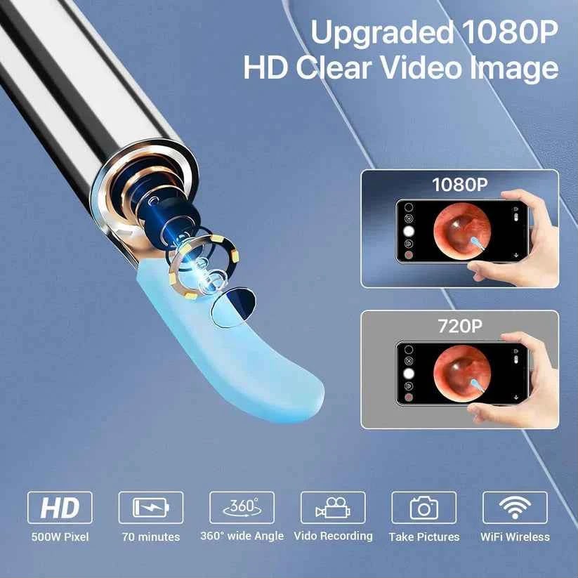 Smart WiFi Ear Cleaner with 1296P HD Camera